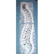 Hand Painted Double Canvas Spine -Chiropractic Art Image