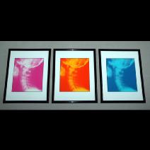 Cervical X-ray Chiropractic Framed Prints Image