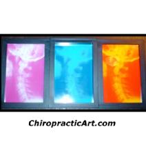 Triple Frame Cervical Spine X-ray Print Image